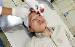 Nhóm côn đồ cầm dao vào trạm Cù Đinh đánh một kiểm lâm viên nhập viện