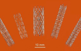 Australia tạo đột phá trong sản xuất stent nhờ công nghệ in 3D