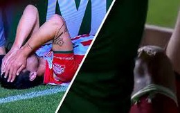 Tai nạn hi hữu và 'ghê sợ' khiến cầu thủ Mexico ôm mặt khóc trên sân