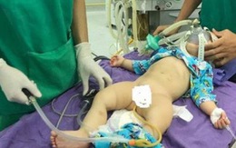 Điều trị lồng ruột ở trẻ em bằng kỹ thuật bơm hơi tại BVĐK Tâm Trí
