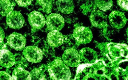 Phát hiện khí ozone có thể khử khuẩn bề mặt có virus corona