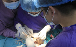 Bảo hiểm xã hội Hà Nội đề nghị báo cáo giá mua stent động mạch vành