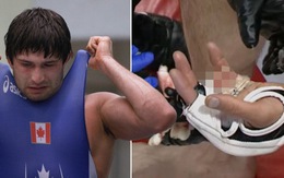 Đang thi đấu, võ sĩ MMA bị xử thua 'nốc ao' vì bị... cụt mất ngón tay