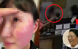 Cảnh sát Hàn Quốc thẩm vấn vợ đại sứ Bỉ vì tát đỏ mặt nhân viên bán hàng