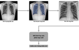 Phát hành sách trắng về ứng dụng trí tuệ nhân tạo cho chẩn đoán và tầm soát bệnh lao