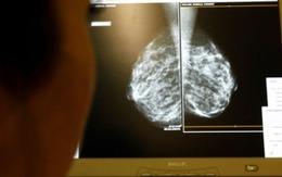 Mỹ tiêm thử nghiệm virus tiêu diệt ung thư trên người