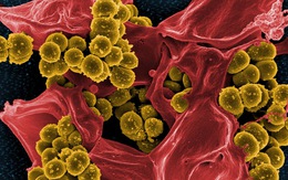 Cảnh báo về siêu vi khuẩn kháng kháng sinh từ lợn lây sang người