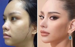 Netizen cười cợt hình ảnh chưa 'dao kéo' của tân Hoa hậu Hoàn vũ Thái Lan