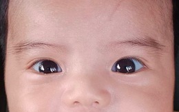 Tại sao mắt trẻ có màu xanh nước biển?