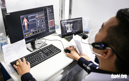 Ứng dụng công nghệ AI, xe chụp X-quang lưu động để tăng cường phát hiện bệnh lao