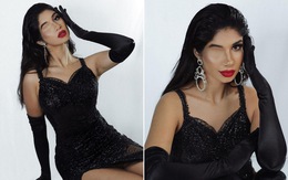 Người đẹp chỉ có một mắt thi Hoa hậu Siêu quốc gia Paraguay