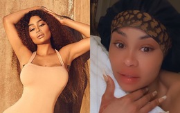 'Mỹ nhân nghiện dao kéo' Blac Chyna tự chê bai nhan sắc, nói mặt đầy filler của mình là điên rồ