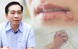 Bác sĩ khuyến cáo: Quan hệ tình dục bằng miệng tiềm ẩn nhiều nguy cơ mắc bệnh
