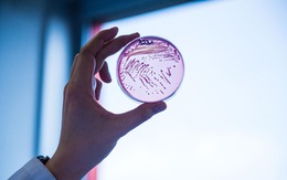 Giới khoa học phát hiện vi khuẩn ‘ma cà rồng’ khát máu người