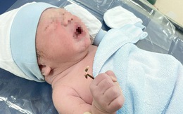 Chuyện hy hữu: Em bé chào đời mang theo vòng tránh thai của mẹ