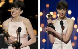 Anne Hathaway: Đường đến vinh quang không chỉ có hoa hồng