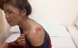 Hai tay đua nữ VN gặp nạn tại Thái Lan