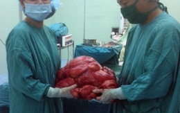 Phẫu thuật lấy khối u 11kg trong ổ bụng bệnh nhân