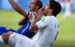 Luis Suarez: "Tôi không cố ý cắn Chiellini"