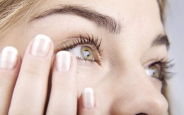 ​Sức khoẻ của bạn: Hiểu về bệnh mộng mắt
