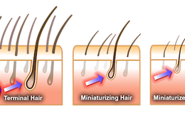 ​Ngăn rụng tóc: những “từ khóa” cần biết