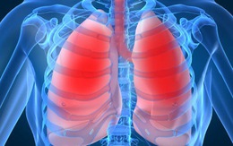 Ứng dụng tế bào gốc trị bệnh phổi tắc nghẽn mãn tính