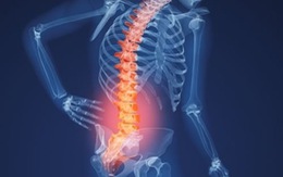 Nắn cột sống khi đau lưng có hiệu quả