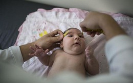 ​Virút Zika có thể gây mất mô não bào thai