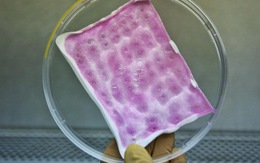 ​Thụy Sĩ phát minh băng chống nhiễm khuẩn ở vết thương bỏng