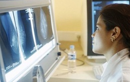 ​X-quang can thiệp, một bước ngoặt trong điều trị ung thư