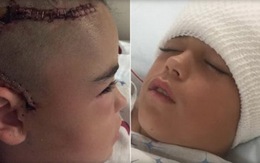 Mẹ đăng ảnh vết mổ đầu con trai kêu gọi đội mũ bảo hiểm