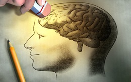 ​Mất nhiễm sắc thể Y có thể làm tăng nguy cơ mắc Alzheimer