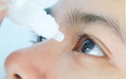 ​Lạm dụng thuốc nhỏ mắt dẫn đến mắc bệnh glôcôm