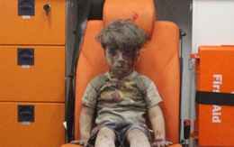 Cậu bé Syria thành biểu tượng nỗi đau chiến tranh