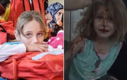 Bé gái Syria khuôn mặt đẫm máu, luôn miệng gọi "Cha ơi!"