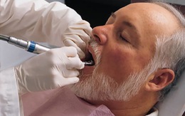 ​Chăm sóc răng miệng ở người cao tuổi