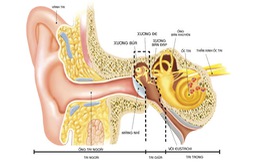 ​Phòng ngừa “thối tai” - bệnh lý thường gặp ở trẻ