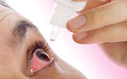 Nhiều người đau mắt đỏ do bệnh đường hô hấp