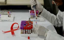 ​Các nhà nghiên cứu Cuba thử nghiệm vắcxin điều trị HIV/AIDS