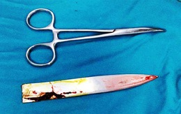 Cứu bệnh nhân bị đâm, lưỡi dao cắm chặt vào lưng