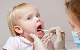 ​Bệnh lý viêm loét miệng ở trẻ