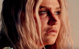 Kesha kể về quá khứ bị lạm dụng tình dục trong MV mới