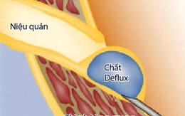 Chích keo sinh học