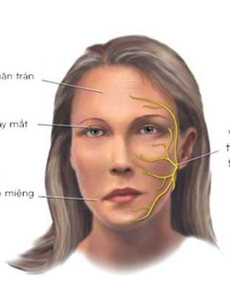 Thời tiết miền Bắc chuyển lạnh, coi chừng liệt dây thần kinh số 7