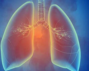 Lần đầu phát hiện hạt vi nhựa ở sâu trong phổi của người sống