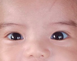 Tại sao mắt trẻ có màu xanh nước biển?