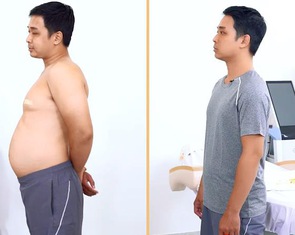 Viện thẩm mỹ Korea thừa nhận sai sót lớn về clip 'siêu giảm béo'