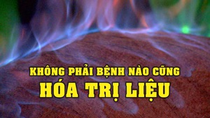 Hỏa trị liệu - Hiệu quả cao nhưng không phải bệnh nào cũng áp dụng