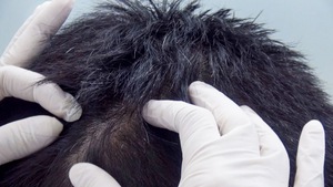 Phút cảnh báo: Người trẻ với nỗi lo tóc bạc sớm