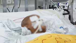 Video: Bé trai 4 tuổi bị kéo đâm vào mắt, xuyên não nguy kịch